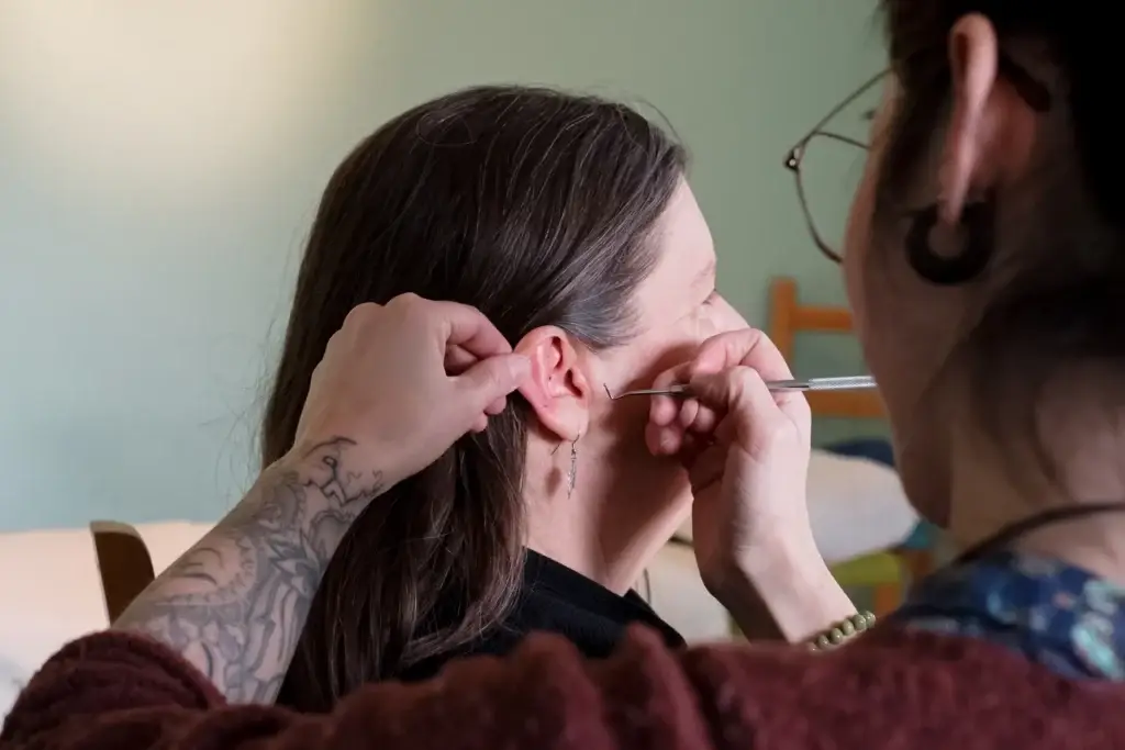 Ohrakupunktur- Zur Regulation von Dysbalancen im Körper